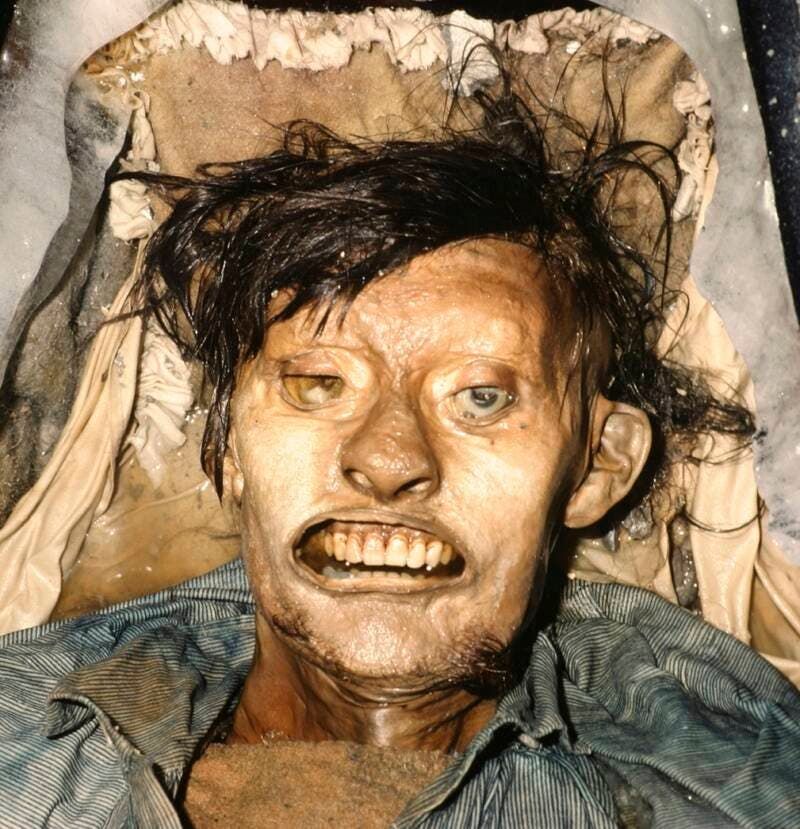 صورة لجثة جون هارتنيل المحنطة أحد أفراد بعثة فرانكلن الذين دفنوا بجزيرة بيتشي