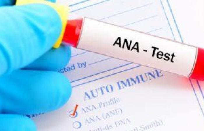 تحليل الأجسام المضادة للنواة ANA وأهميته في اكتشاف الأمراض