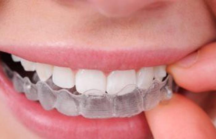 7 حقائق يجب معرفتها قبل تركيب التقويم الشفاف على أسنانك
