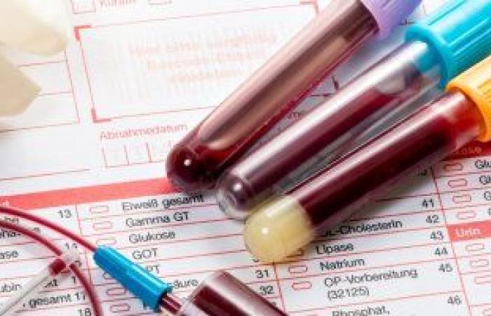 تحليل IFE يكشف الإصابة بسرطان الدم.. طبيبك سيطلبه فى هذه الحالات