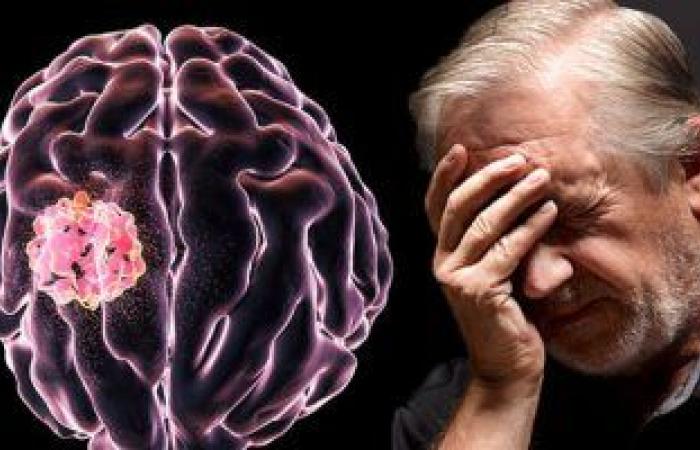 هل تؤثر الأورام السرطانية فى المخ على تصرفات وشخصية المريض؟