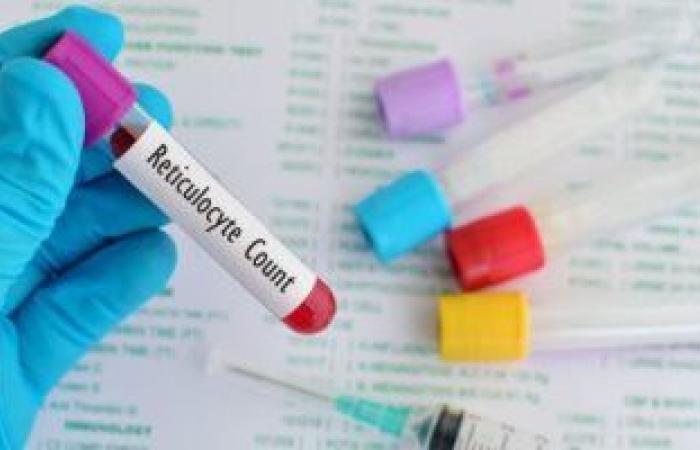 دراسة جديدة: فصيلة الدم لا تؤثر على خطر الإصابة بفيروس كورونا الحاد