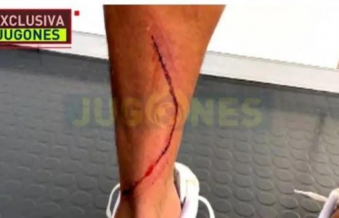 صورة مؤلمة.. شاهد إصابة لاعب ريال مدريد