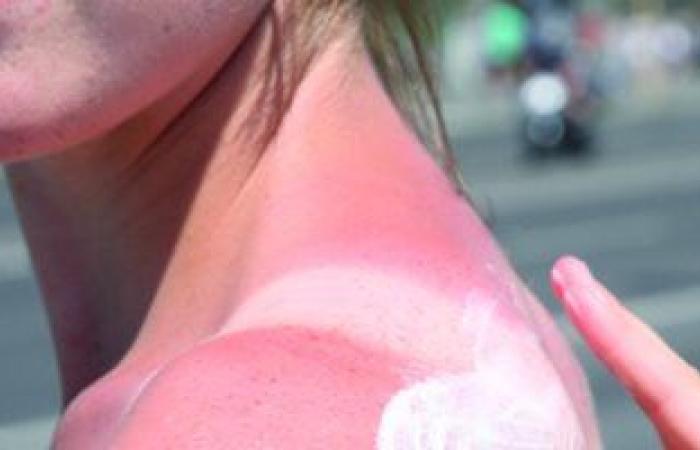 نصائح للوقاية من حروق الجلد بسبب أشعة الشمس..  حافظ على رطوبتك