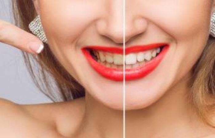 6 نصائح لتنظيف الأسنان والتخلص من اصفرارها.. اعرف متى تزور الطبيب