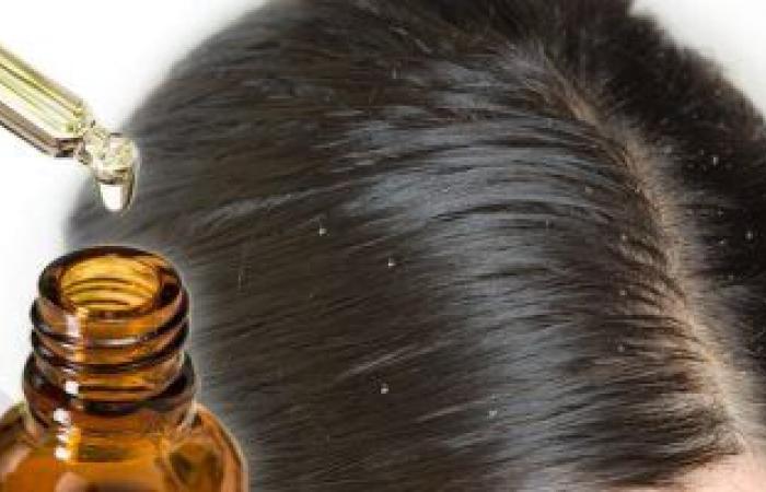 4 أسباب وراء انتشار قشرة الشعر.. تعرف على طرق العلاج