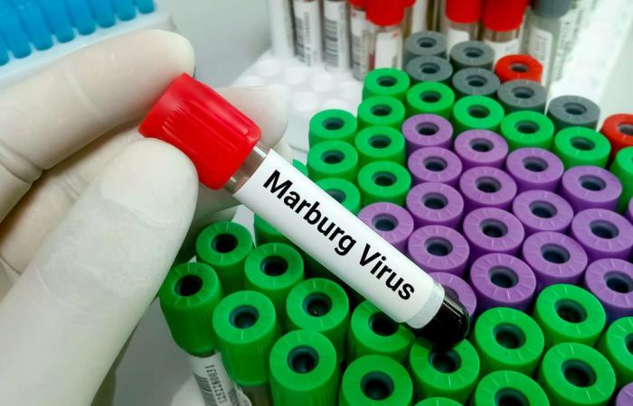 مخاوف من تفشى فيروس ماربورغ.. كل ما تريد معرفته عن المرض الشبيه بالإيبولا