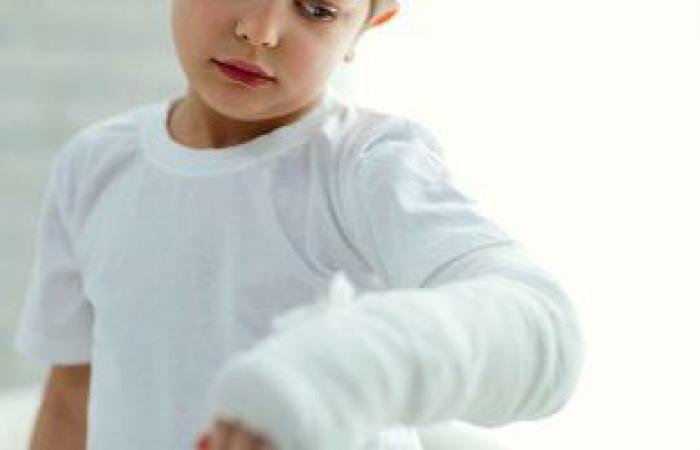 علامات الإصابة بكسر فى العظام عند الأطفال والإسعافات الأولية