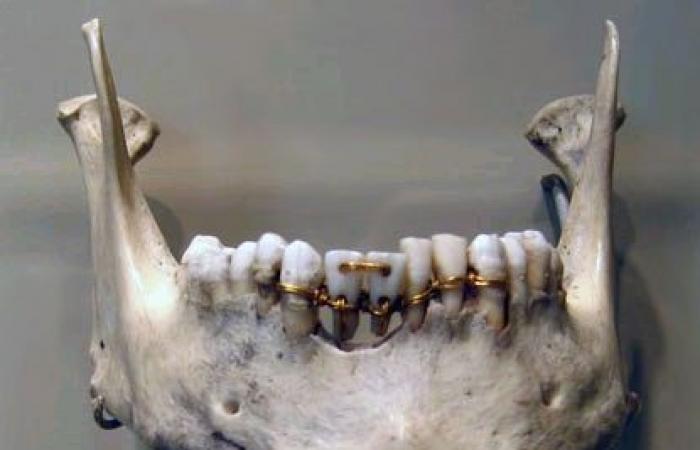 بمناسبة افتتاح طريق الكباش.. أول طبيب أسنان فى العالم من مصر الفرعونية
