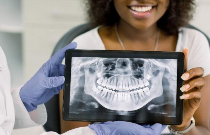 ماذا تكشف الأشعة عن صحة أسنانك وما أنواعها؟