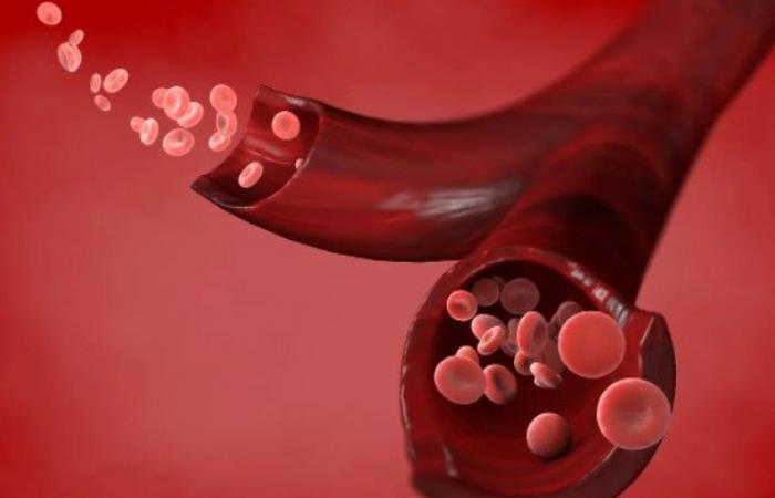 تعرف على فصيلة الدم الأكثر عرضة للإصابة بأمراض القلب