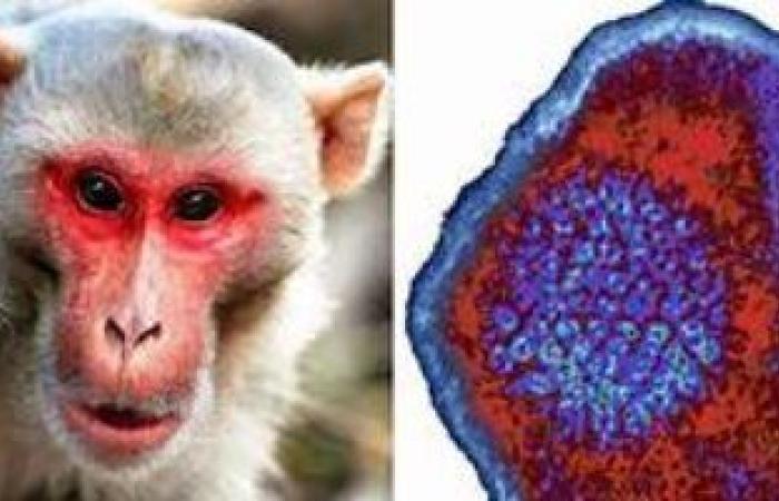 4 خرافات حول فيروس جدرى القرود وتصحيحها