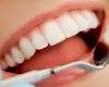 الفم بوابة العديد من المشاكل الصحية.. تعرف على أضرار عدم تنظيف الأسنان