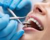 دراسة: فحص كورونا الجماعى فى عيادات الأسنان قد يمنع الانتقال الصامت للفيروس