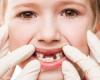 فوائد الماء لحماية الفم والأسنان لدى الأطفال.. يمنع التهابات اللثة