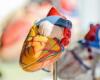 الأسبرين أفضل من الوارفارين لمنع تجلط الدم عند الأطفال بعد جراحة القلب