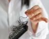 أكثر من خُمس مرضى فيروس كورونا يفقدون شعرهم في غضون 6 أشهر من الإصابة