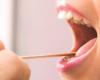كيف يؤثر إهمال نظافة الفم على الصحة العامة؟ اعرف الإجابة
