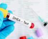 تعرف على تحليل DHEA-S الذى يكشف نسبة هرمون الأندروجين فى الدم