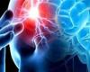 دراسة: فصيلة دمك قد تؤثر على مخاطر الإصابة بالسكتة الدماغية