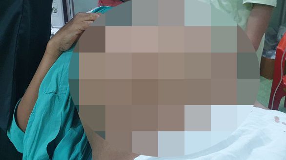 صورة بطن المريض قبل ازالة الورم