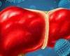 5 طرق لتحسين صحة الكبد.. تعرف عليها