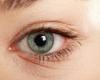 ماذا تعرف عن حول العين وأهم طرق العلاج؟